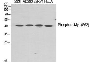 Western Blotting (WB) image for anti-Myc Proto-Oncogene protein (MYC) (pSer62) antibody (ABIN5959056) (c-MYC antibody  (pSer62))