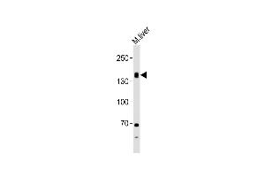 Anti-TSHR Antibody (Center) at 1:1000 dilution + mouse liver lysates Lysates/proteins at 20 μg per lane. (TSH receptor antibody  (AA 217-252))