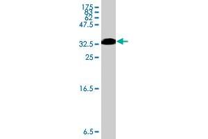 Western Blot detection against Immunogen (37 KDa) . (MID1 antibody  (AA 441-540))