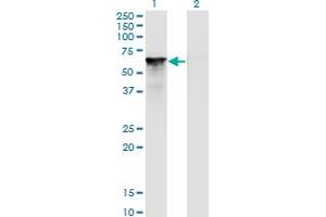 Western Blot analysis of SF1 expression in transfected 293T cell line by SF1 monoclonal antibody (M01), clone 2E12. (Splicing Factor 1 antibody  (AA 1-110))