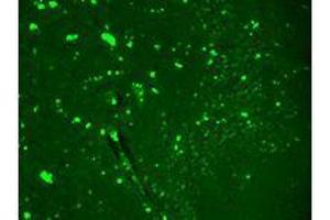 Image no. 4 for anti-Sodium Channel, Voltage-Gated, Type IX, alpha Subunit (SCN9A) (AA 1751-1946) antibody (ABIN361773)