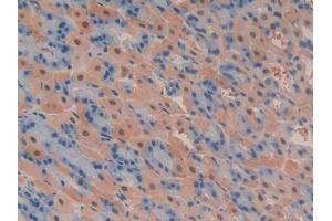 DAB staining on IHC-P; Samples: Mouse Stomach Tissue (PIK3C2A antibody  (AA 349-611))