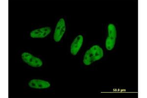 Immunofluorescence of purified MaxPab antibody to RBM9 on HepG2 cell. (RBM9 antibody  (AA 1-380))