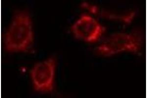 ABIN6275406 staining HT29 cells by IF/ICC. (NDRG4 antibody  (Internal Region))