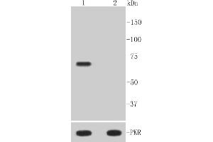 Lane 1: Hela treated with Calyculin A and TNF-alpha whole cell lysates, Lane 2: Untreated Hela whole cell lysates, probed with PKR(T446) (10A1) Monoclonal Antibody  at 1:1000 overnight at 4˚C. (EIF2AK2 antibody  (pThr446))
