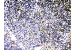 Anti- TNF Receptor II Picoband antibody, IHC(P) IHC(P): Mouse Thymus Tissue (TNFRSF1B antibody  (C-Term))