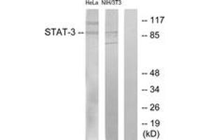 Western blot analysis of extracts from HeLa/3T3 cells, using STAT3 (Ab-705) Antibody.