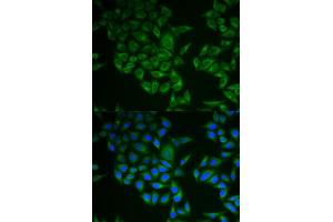 Immunofluorescence analysis of A549 cell using CD247 antibody.