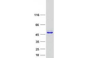 Validation with Western Blot