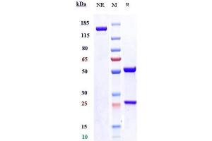 Anti-SLITRK6 Reference Antibody (sirtratumab) on SDS-PAGE under reducing (R) condition. (Recombinant SLITRK6 (Sirtratumab Biosimilar) antibody)