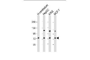 SMPD1 anticorps  (C-Term)