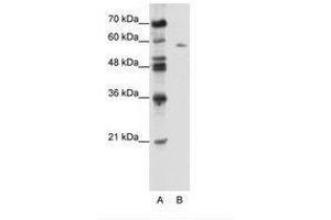 BTBD14A Antikörper  (AA 491-540)