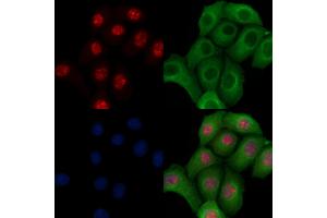 ABIN6256599 and ABIN6267082 staining Heat-shock treated Hela cells by IF/ICC.