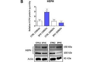 Iron export machinery-related hephaestin (HEPH) and the hemochromatosis gene (HFE) related to systemic iron loading are elevated at the mRNA level but not on the protein level in tumor-initiating cells (TICs)Expression of the HEPH gene at the mRNA level in breast non-malignant cell line MCF10A, in TICs derived from breast cancer cell lines MCF-7, BT-474, T-47D and ZR-75-30 as well as from prostate cancer cell lines DU-145 and LNCaP has been determined (A) together with protein levels in the MCF-7 cell line (CTRL) and MCF-7 derived spheres (SPH) (B). (Hephaestin antibody  (AA 21-120))