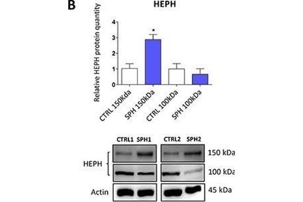 Hephaestin antibody  (AA 21-120)