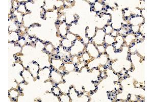 ABIN7094167 and ABIN7098211 at 1/100 staining mouse lung tissue by IHC-P.