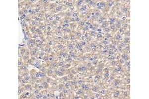 Immunohistochemistry analysis of paraffin-embedded mouse liver using,TFR2 (ABIN7075965) at dilution of 1: 400 (Transferrin Receptor 2 antibody)