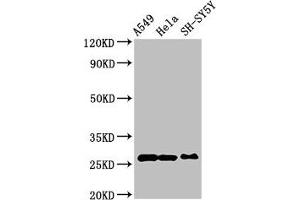 Western Blot Positive WB detected in: A549 whole cell lysate, Hela whole cell lysate, SH-SY5Y whole cell lysate All lanes: PRDX6 antibody at 4 μg/mL Secondary Goat polyclonal to rabbit IgG at 1/50000 dilution Predicted band size: 26 kDa Observed band size: 26 kDa (Peroxiredoxin 6 antibody  (AA 87-224))