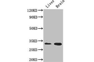 Western Blot Positive WB detected in: Mouse liver tissue, Mouse brain tissue All lanes: CD37 antibody at 2.