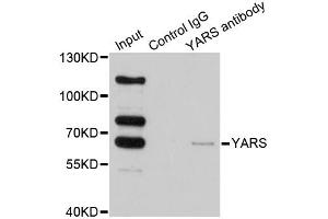 Immunoprecipitation analysis of 200ug extracts of HeLa cells using 1ug YARS antibody.