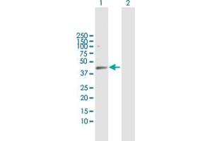 Western Blot analysis of HDAC8 expression in transfected 293T cell line by HDAC8 MaxPab polyclonal antibody. (HDAC8 antibody  (AA 1-377))