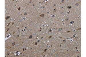 The image on the left is immunohistochemistry of paraffin-embedded Human brain tissue using ABIN7129446(FAM89B Antibody) at dilution 1/30, on the right is treated with fusion protein. (FAM89B antibody)