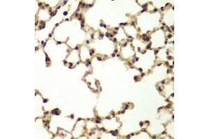 Immunohistochemistry of paraffin-embedded mouse lung using ERCC3 antibody at dilution of 1:200 (400x lens). (ERCC3 antibody)