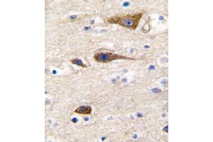 Formalin-fixed and paraffin-embedded human brain tissue reacted with CYP2R1 antibody (Center), which was peroxidase-conjugated to the secondary antibody, followed by DAB staining.