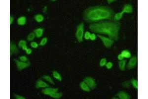 Figure:FITC staining on IHC-P Simple: Hela cells (FLNB antibody  (AA 1-237))