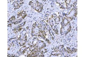 IHC analysis of MCM7 using anti-MCM7 antibody (ABIN7601968).