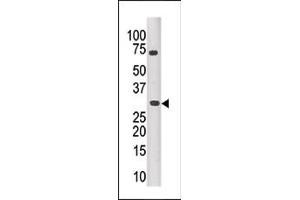 The anti-PIM3 Pab (ABIN391253 and ABIN2841313) is used in Western blot to detect PIM3 in mouse kidney tissue lysate. (PIM3 antibody  (C-Term))