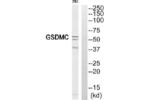 Western blot analysis of extracts from 293 cell, using GSDMC antibody. (MLZE antibody  (Internal Region))
