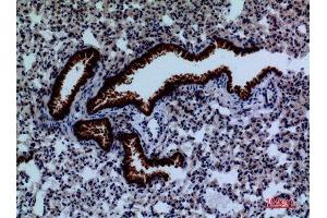 Immunohistochemistry (IHC) analysis of paraffin-embedded Mouse Lung, antibody was diluted at 1:100. (DPYD antibody  (Internal Region))