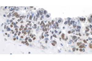 Immunohistochemistry (IHC) image for anti-Topoisomerase (DNA) II beta 180kDa (TOP2B) (C-Term) antibody (ABIN7454697) (TOP2B antibody  (C-Term))