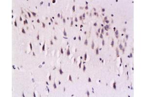 Formalin-fixed and paraffin embedded rat brain labeled with Mouse Anti-Calcineurin A/PP-2B alpha 1 Polyclonal Antibody , Unconjugated 1:200 followed by conjugation to the secondary antibody and DAB staining (Calcineurin A antibody  (AA 15-80))