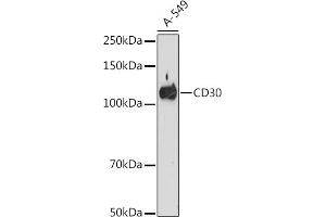 Western blot analysis of extracts of A-549 cells, using CD30 antibody (ABIN7271072) at 1:500 dilution. (TNFRSF8 antibody)