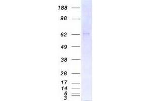 Validation with Western Blot