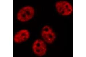 ABIN6275070 staining  Hela cells by IF/ICC. (POLR1B antibody  (Internal Region))