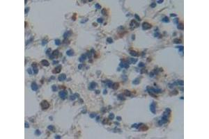 IHC-P analysis of Mouse Tissue, with DAB staining. (URGCP antibody  (AA 689-924))
