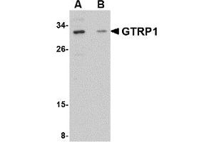 Western Blotting (WB) image for anti-Growth Hormone Regulated TBC Protein 1 (GRTP1) (Middle Region) antibody (ABIN1030945) (GRTP1 antibody  (Middle Region))