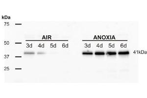 Western Blotting (WB) image for anti-Alcohol Dehydrogenase (ADH) antibody (ABIN7540305) (Alcohol Dehydrogenase (ADH) antibody)
