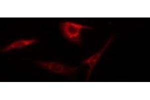 ABIN6275184 staining HepG2 by IF/ICC. (HNRPLL antibody  (Internal Region))