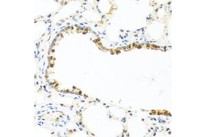 Immunohistochemistry of paraffin-embedded rat lung using APCS antibody at dilution of 1:100 (40x lens). (APCS antibody)