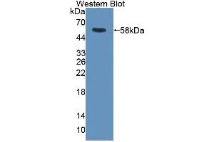 Detection of Recombinant RGS6, Rat using Polyclonal Antibody to Regulator Of G Protein Signaling 6 (RGS6) (RGS6 antibody  (AA 1-472))