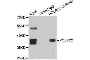 Immunoprecipitation analysis of 150ug extracts of SW620 cells using 3ug POLR2C antibody. (POLR2C antibody)
