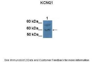 Lanes:   100 ug CHO cell lysate  Primary Antibody Dilution:   1:1000  Secondary Antibody:   Goat anti-rabbit HRP  Secondary Antibody Dilution:   1:25000  Gene Name:   KCNQ1  Submitted by:   Anonymous (KCNQ1 antibody  (N-Term))