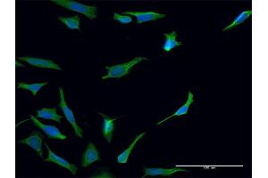 Immunofluorescence of monoclonal antibody to TGM2 on HeLa cell. (Transglutaminase 2 antibody  (AA 1-120))