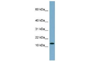 WB Suggested Anti-RPS27L Antibody Titration: 0. (RPS27L antibody  (N-Term))
