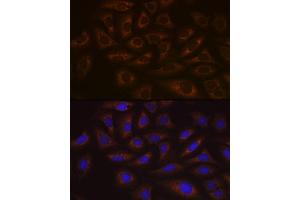 Immunofluorescence analysis of U-2 OS cells using UBE2C Rabbit mAb (ABIN1680590, ABIN3019392, ABIN3019393 and ABIN7101768) at dilution of 1:100 (40x lens). (UBE2C antibody)