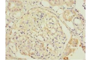 Immunohistochemistry of paraffin-embedded human kidney tissue using ABIN7149924 at dilution of 1:100 (DPYS antibody  (AA 250-519))